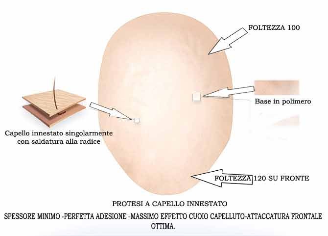impianto capillare innesto