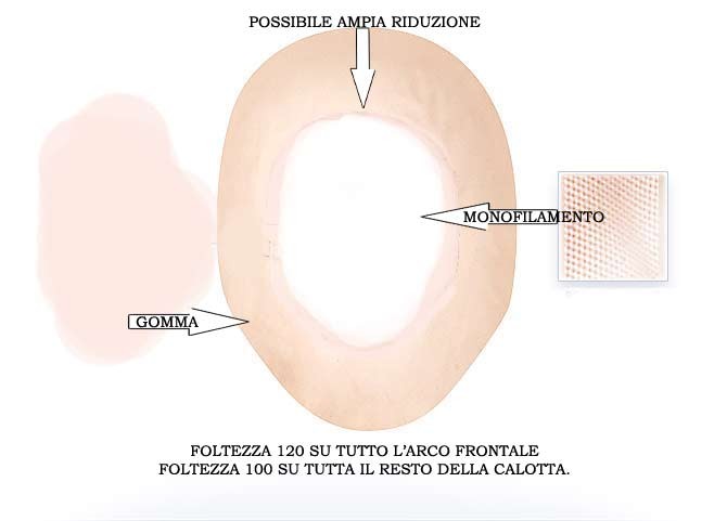 Impianto Capillare Standard 3