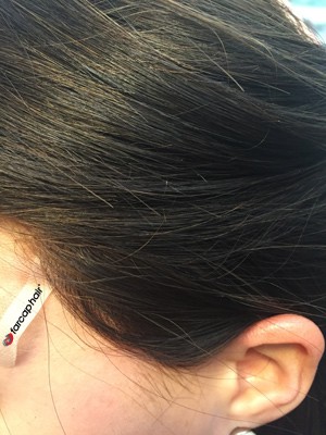 Alopecia parrucche Farcaphair parrucche on line