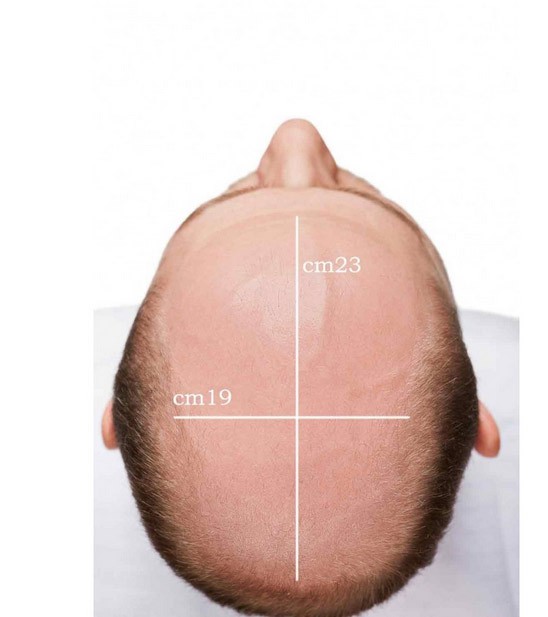Protesi capelli Farcap 5 riccio