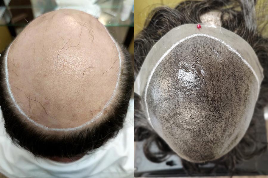 Come modificare una protesi di capelli Come modificare una protesi di capelli